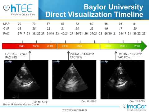 Baylor University:  Direct Visualization Timeline