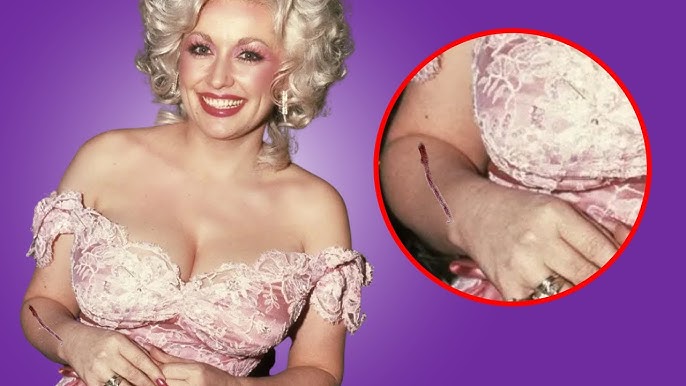She Only Wears Long Sleeves, and Today We Finally Know Why