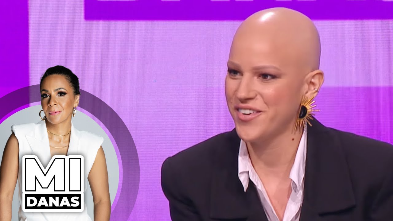 Problem sa alopecijom | Sonja Milosavljević | MI DANAS