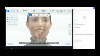 Shining3D Aoralscan Elite Intraoral Photogrammetry Technology (IPG) Global Launch Event