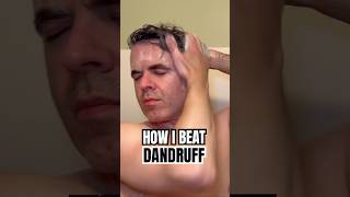How I Beat Dandruff