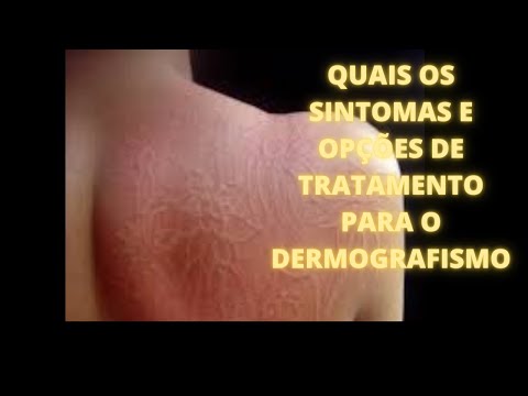 Vídeo: Dermografismo - Sinais, Tratamento, Causas, Formas, Diagnóstico