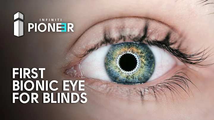 Worlds First Bionic Eye Will Cure Blind People