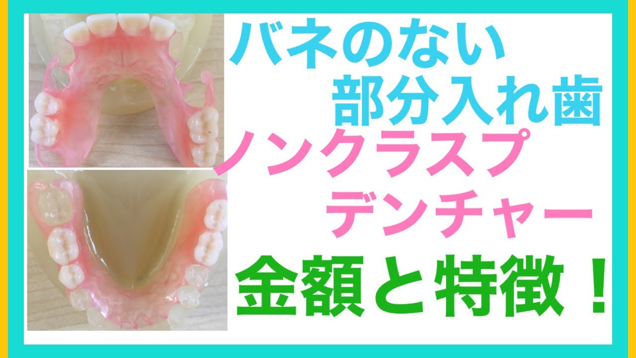 歯科医師ニイノミの健康ちゃんねる‼️by2103。部分入れ歯、ノンクラスプデンチャーの金額に関してお伝えします‼️