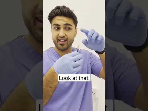 What Is A Cannula In Aesthetics Cannula Cannulafiller Cannulavsneedle Fillercanula 