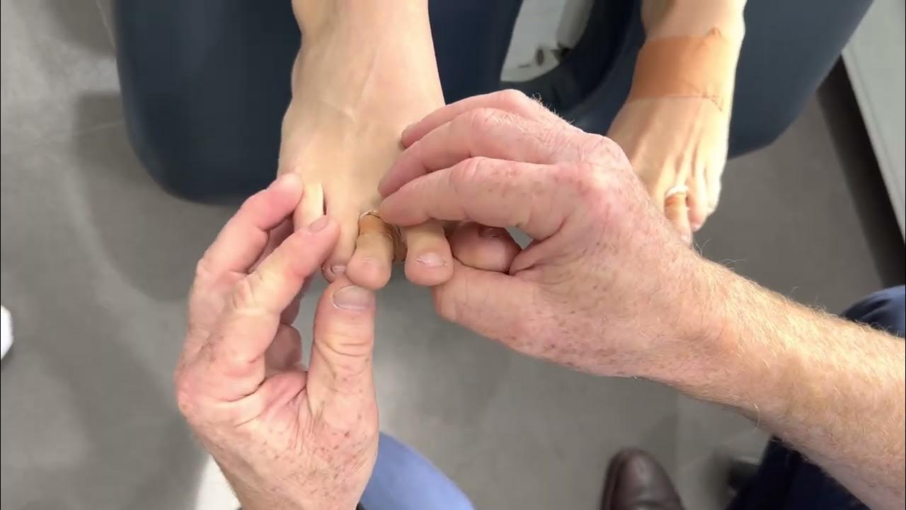 Strapping tape for Plantar Plate Tear or Volar Plate Injury YouTube