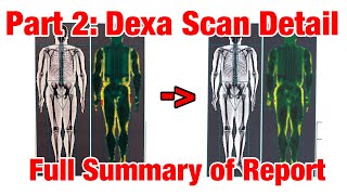 Dexa Scan Review: Detailed Review of Report.  Body Fat % Test, Muscle Mass, Bone Mass
