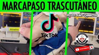 REPASO DE ARRITMIAS Parte 2//Live por TikTok By Dr. Zamarrón
