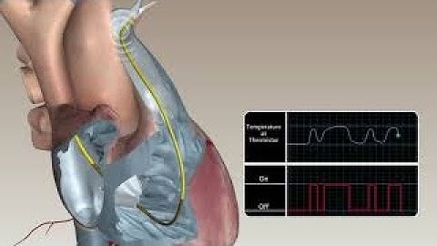 Swan Ganz continuous cardiac output animation