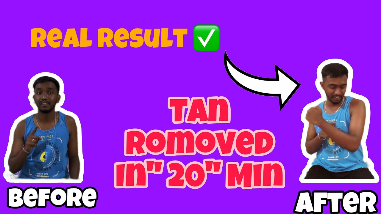 Remove Sun-Tan Instantly in Just 20Mins !😱 niconi gluta kojic skin polish review  