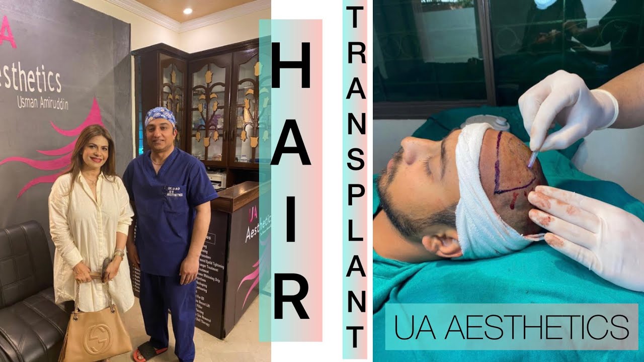 HAIR TRANSPLANT by UA AESTHETICS - YouTube
