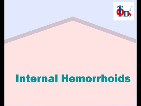 Internal Hemorrhoid - TODS