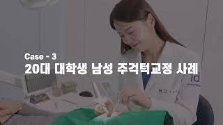 #주걱턱 꼭 수술해야 하나요?? #주걱턱교정 #교정전후 알아봅시다