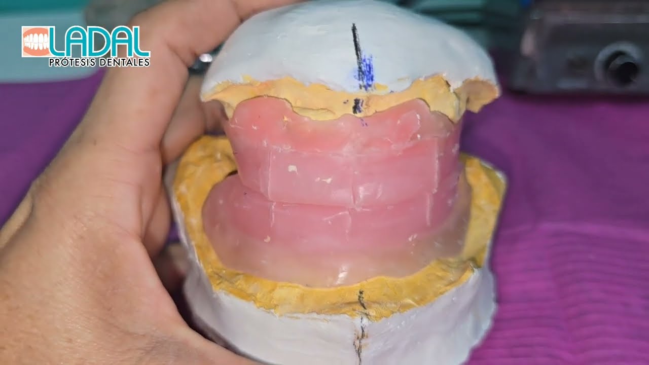 Enfilado de Prostodoncia total 1x28