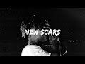 [FREE] (SAD) Juice WRLD Type Beat - "New Scars"