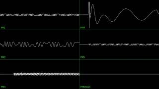 Vectorman - Title Screen Oscilloscope View