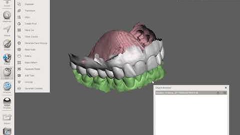 Create bite in meshmixer for Invisalign