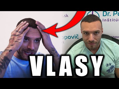 Video: Znižuje strihanie vlasov vypadávanie vlasov?