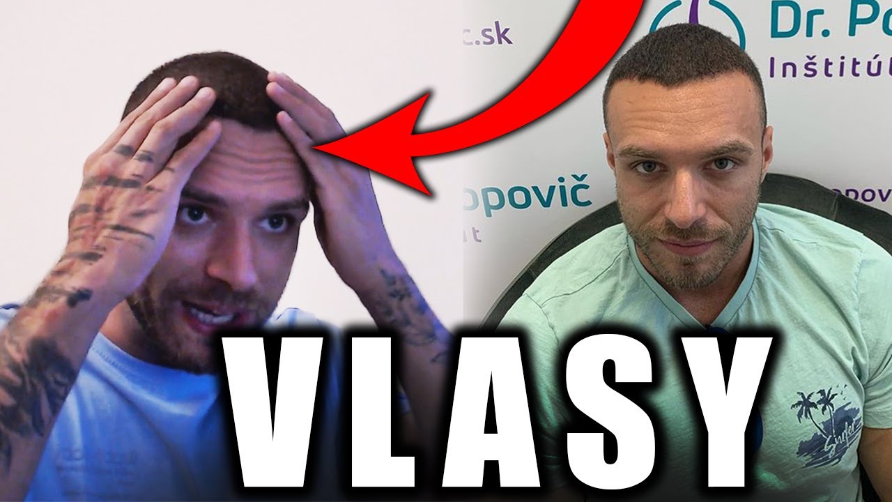 Restt - 4 mesiace po TRANSPLANTÁCII, Kedy ďalšia transplantácia?