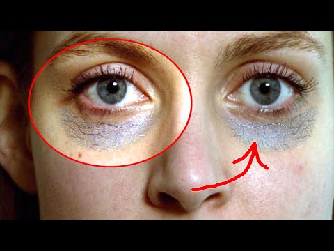 in just 45 hours How to Remove Dark Circles Naturally (98% Results) ? How To Remove Dark Circles