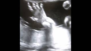 Traumprinz - Floodgate [APW-5]