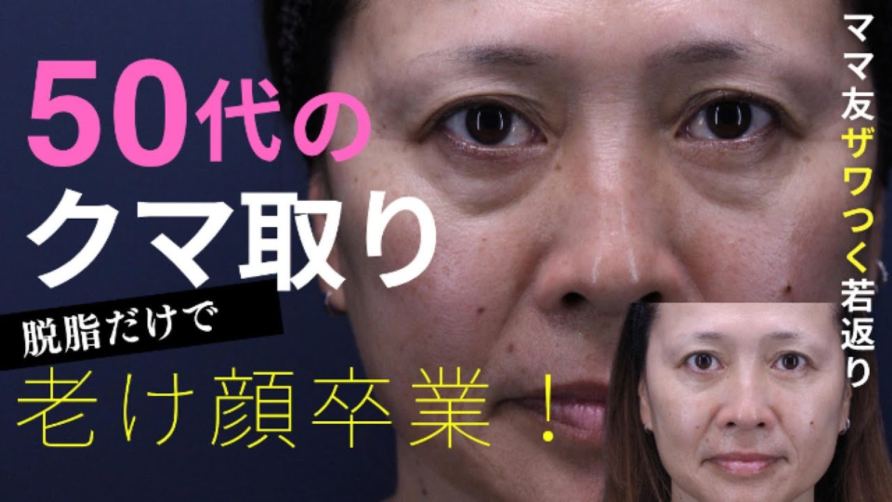 ママ友びっくり！老け顔卒業✨