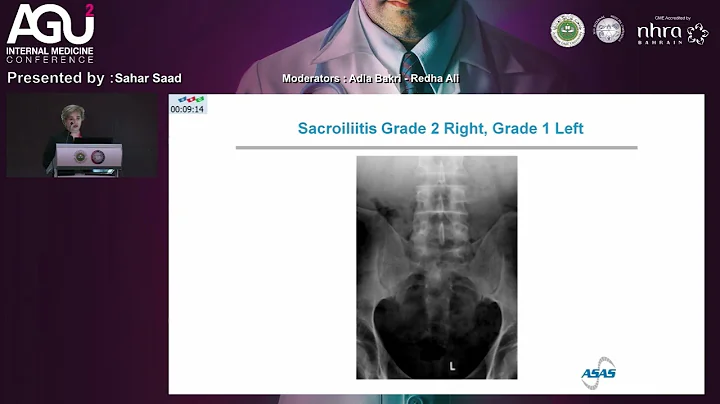 41  Sahar Saad   Mechanical and Inflammatory Back ...