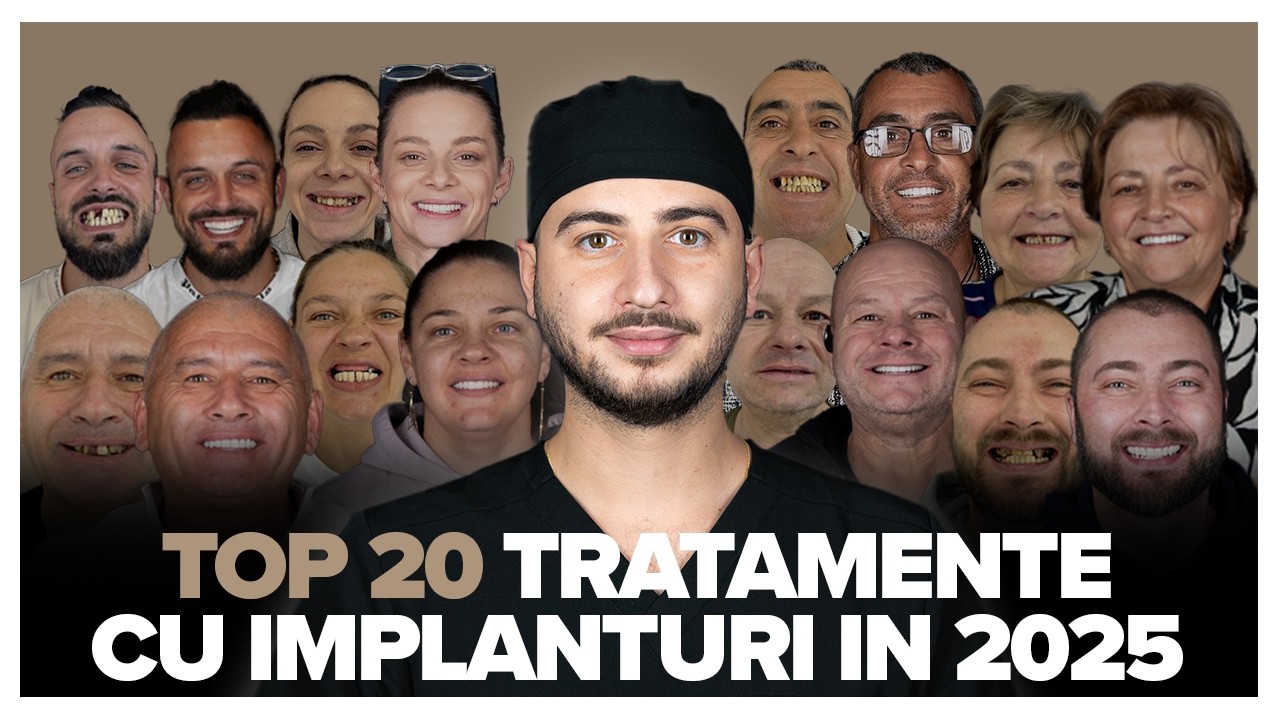 Top 20 Transformări in 2025: Dantura Fixă pe Implanturi și Cazuri Mixte | Transformări Reale!