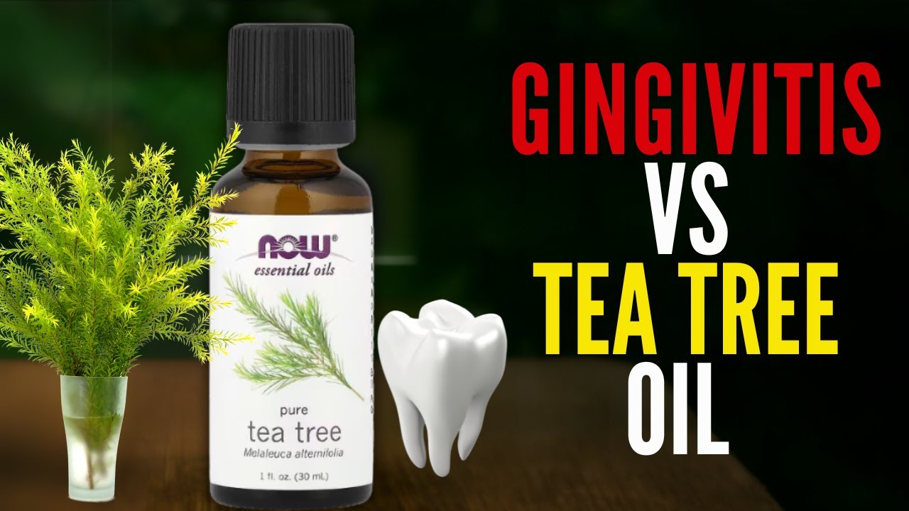 🦷 Gingivitis Vs Tea Tree Oil | Essential Oils and Gum Health