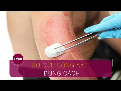 Video: Phải làm gì nếu axit axetic dính vào da?