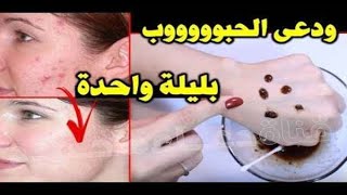 علاج حب الشباب،أثار الحبوب،إزالة إسمرار الشمس