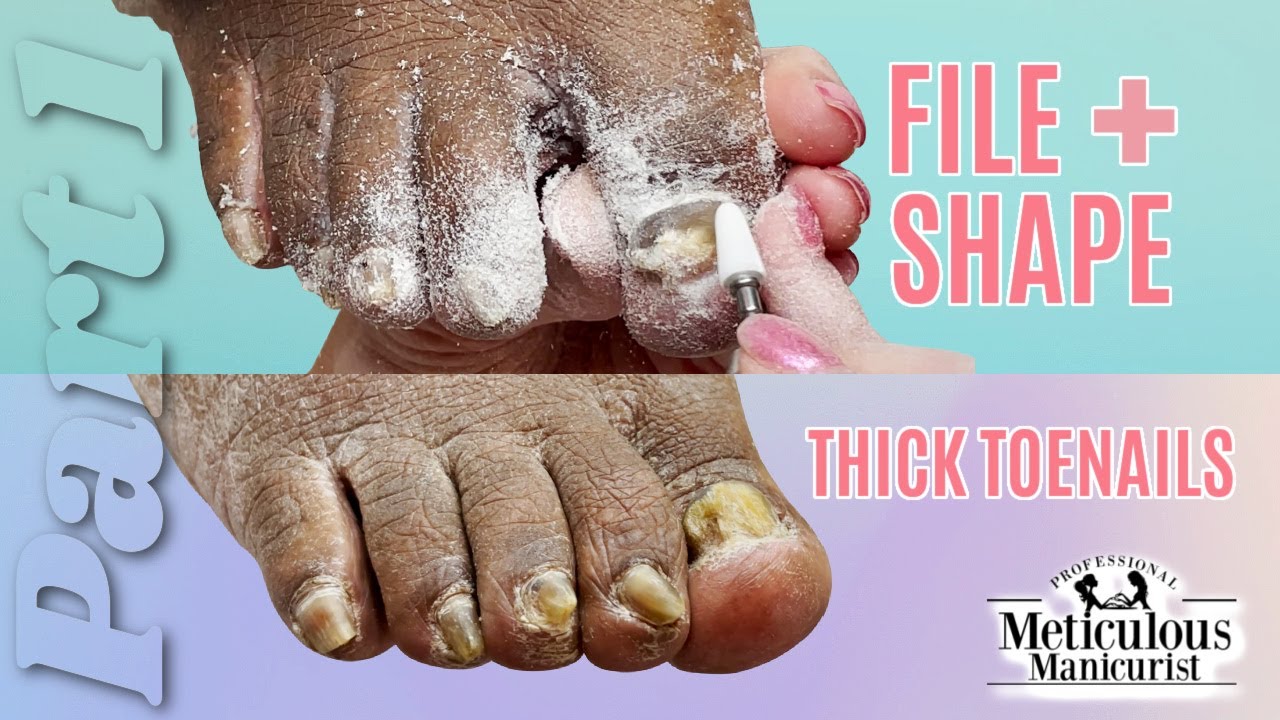 How To File Thin Shape Thick Toenails part 1 YouTube How To File Thin Shape Thick Toenails part 1 YouTube
