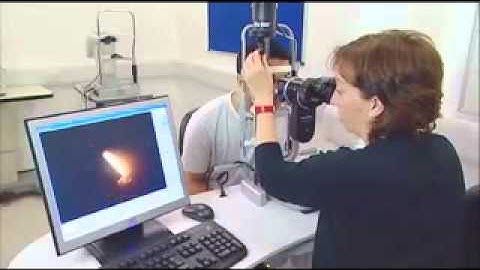 Tear Film Examination and Meniscus Assessment