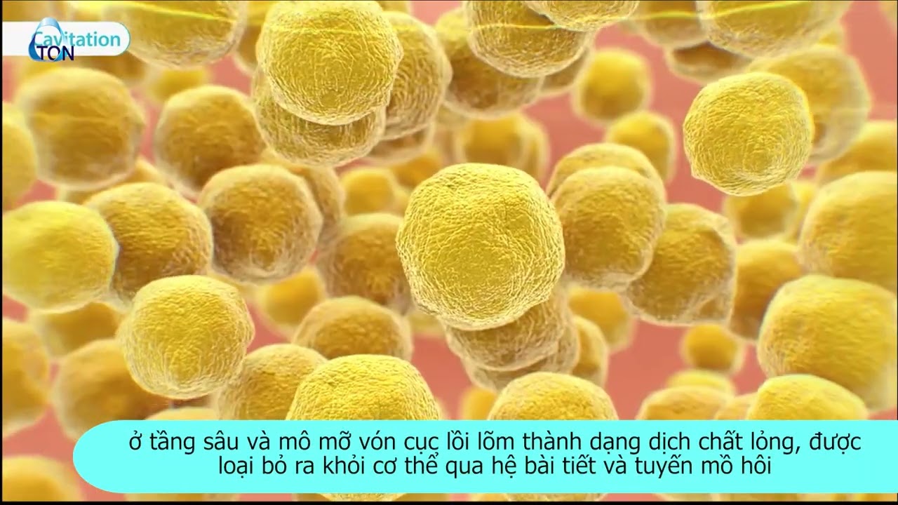 LIPO X Cavitation + RF + Endermology | Zton Việt Nam