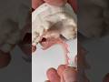 AcryGrip flipper that was just completed in my lab for Dr. Victor Moncada in Texas