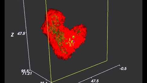 ACGT PROJECT: The Oncosimulator