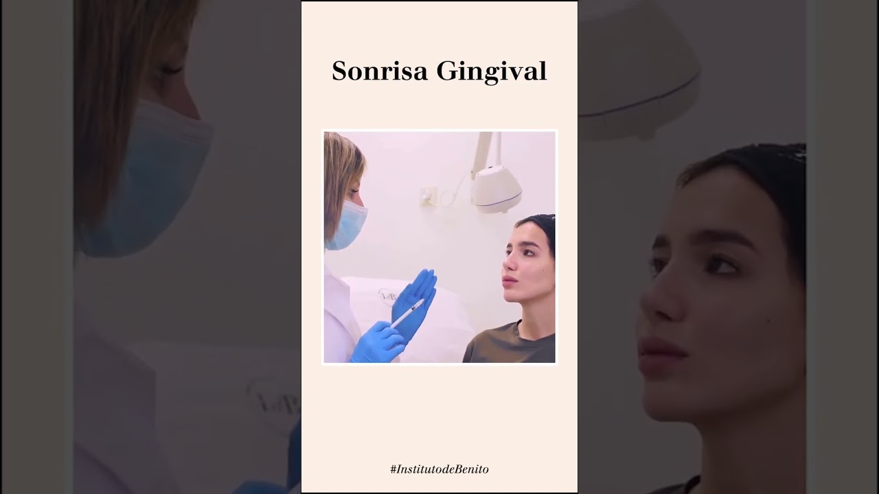 Tratamiento con la dra Cruz para sonrisa gingival