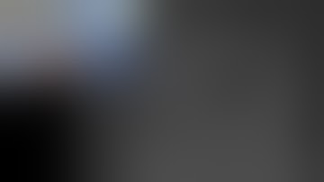 Transradial Prostate Artery Embolization for Benign Prostatic Hyperplasia (BPH)