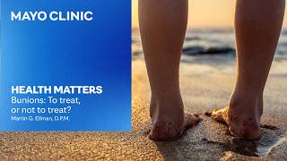Bunions explained: Causes, treatment and foot care | Mayo Clinic Health Matters Podcast