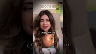 30 seconds to guess the disease - Part 2#SkinHealth #AcneCare #MedicalAwareness