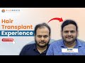 Arvind’s Hair Transplant Journey at AlloRoots - Before and After Results