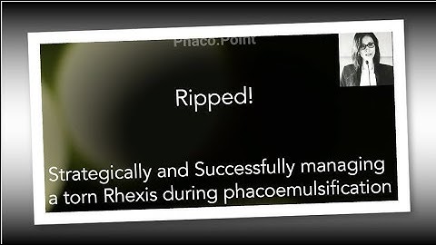 " RIPPED" - strategically and successfully managing a torn rhexis during phacoemulsification.