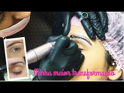 Vídeo: Maria Pogrebnyak transplantou cabelo da nuca para as sobrancelhas