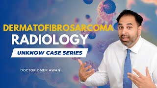Dermatofibrosarcoma Protuberans: A Guide for Medical Students | Dr Omer Awan screenshot 2