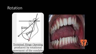 Dental Occlusion - 2 | Mandibular movements|Canine guided occlusion |Group function occlusion