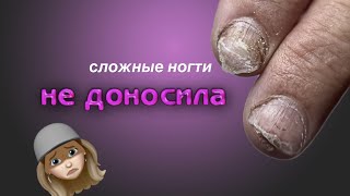 коррекция сложных ногтей 🤯 оторвало кусок ложа