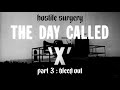  The Day Called 'X', part 3: bleeding out