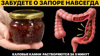 Забудете о запоре навсегда-каловые камни растворяются за 5 минут ! #запор