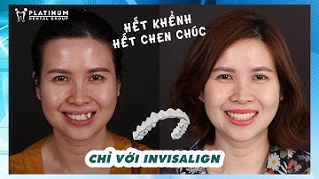 Thẩm mỹ nụ cười với niềng răng trong suốt INVISALIGN | Platinum Dental Group
