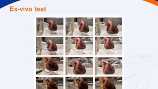 CTSM Cardioscope short presentation Nov 2014